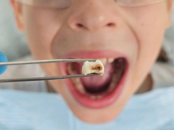 Best Dentist for Dental Trauma  in Andrews, SC